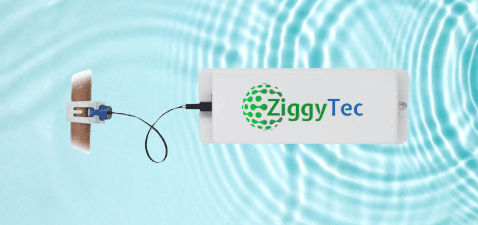 ZiggyTec Smart Legionella Control